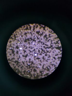 Ein Bluttropfen unter dem Dunkelfeld-Mikroskop